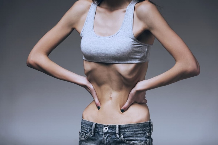 Anoreksiya Nervoza Nedir ? Belirtileri Nelerdir?