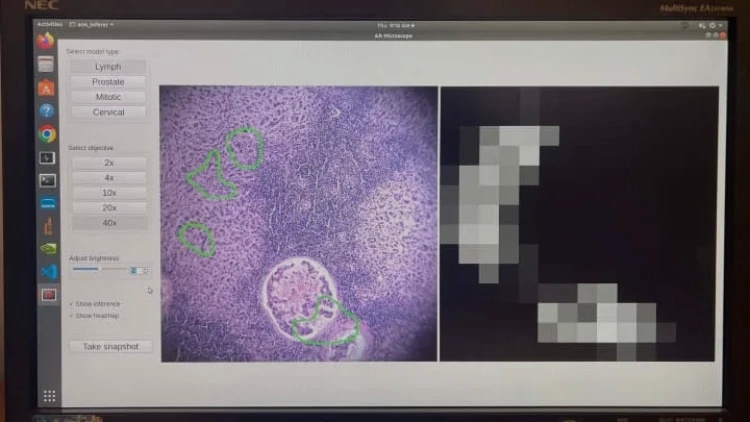 Google, Yapay Zekalı Mikroskopla Kanser Tespitini Kolaylaştırmayı Hedefliyor