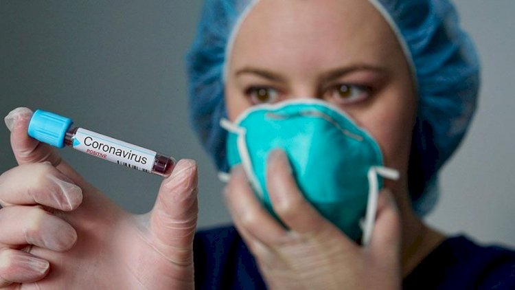 koronavirus susu nedir2775